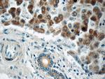 ARFIP2 Antibody in Immunohistochemistry (Paraffin) (IHC (P))
