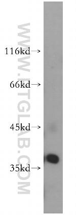 ARFIP2 Antibody in Western Blot (WB)