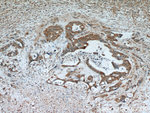 AFP Antibody in Immunohistochemistry (Paraffin) (IHC (P))