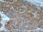AFP Antibody in Immunohistochemistry (Paraffin) (IHC (P))