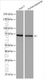 AFP Antibody in Western Blot (WB)