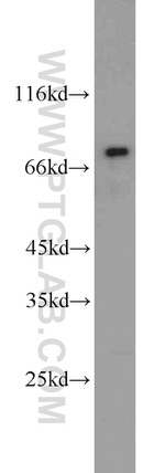 AFP Antibody in Western Blot (WB)