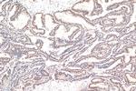 NACC1 Antibody in Immunohistochemistry (Paraffin) (IHC (P))