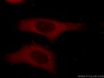 alpha Tubulin Antibody in Immunocytochemistry (ICC/IF)