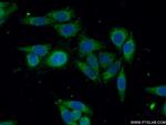 GSTO2 Antibody in Immunocytochemistry (ICC/IF)