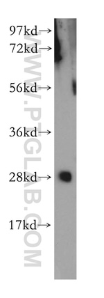 GSTO2 Antibody in Western Blot (WB)