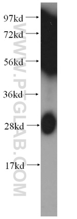 GSTO2 Antibody in Western Blot (WB)