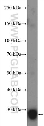 GSTO2 Antibody in Western Blot (WB)