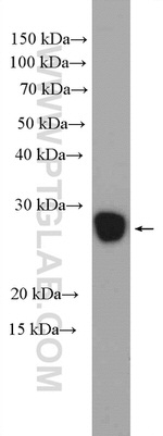 GSTO2 Antibody in Western Blot (WB)