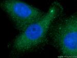 CDR2L Antibody in Immunocytochemistry (ICC/IF)