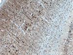CDR2L Antibody in Immunohistochemistry (Paraffin) (IHC (P))