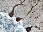 CDR2L Antibody in Immunohistochemistry (Paraffin) (IHC (P))