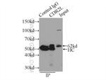 CDR2L Antibody in Immunoprecipitation (IP)
