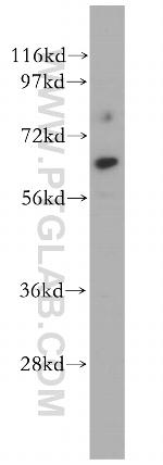 CDR2L Antibody in Western Blot (WB)