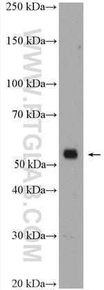 CDR2L Antibody in Western Blot (WB)