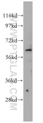 CDR2L Antibody in Western Blot (WB)