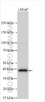 SIAE Antibody in Western Blot (WB)