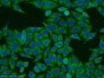 RINT1 Antibody in Immunocytochemistry (ICC/IF)