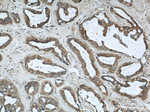 RINT1 Antibody in Immunohistochemistry (Paraffin) (IHC (P))