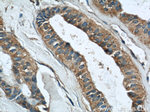 RINT1 Antibody in Immunohistochemistry (Paraffin) (IHC (P))
