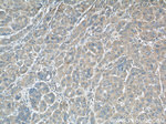 RINT1 Antibody in Immunohistochemistry (Paraffin) (IHC (P))