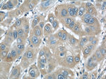 RINT1 Antibody in Immunohistochemistry (Paraffin) (IHC (P))