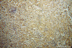 RINT1 Antibody in Immunohistochemistry (Paraffin) (IHC (P))
