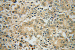 RINT1 Antibody in Immunohistochemistry (Paraffin) (IHC (P))