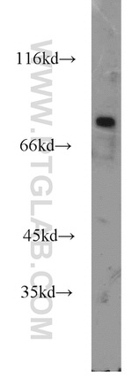 RINT1 Antibody in Western Blot (WB)