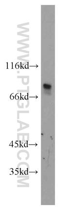 RINT1 Antibody in Western Blot (WB)