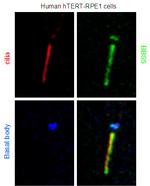 BBS5 Antibody in Immunocytochemistry (ICC/IF)