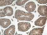 BBS5 Antibody in Immunohistochemistry (Paraffin) (IHC (P))