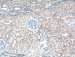 BBS5 Antibody in Immunohistochemistry (Paraffin) (IHC (P))