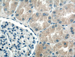 BBS5 Antibody in Immunohistochemistry (Paraffin) (IHC (P))