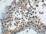 BBS5 Antibody in Immunohistochemistry (Paraffin) (IHC (P))