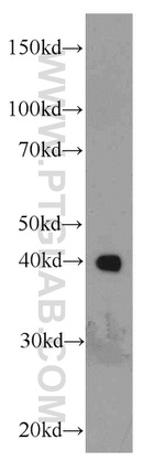 BBS5 Antibody in Western Blot (WB)