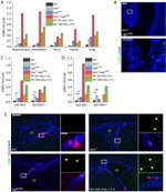 Ki-67 Antibody in Immunohistochemistry (IHC)