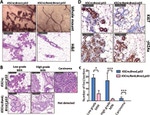 Ki-67 Antibody in Immunohistochemistry (IHC)