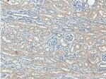 FBXO27 Antibody in Immunohistochemistry (Paraffin) (IHC (P))