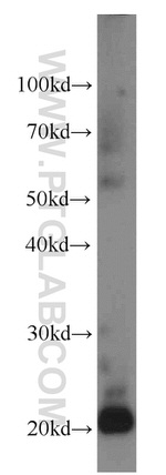 TMEM27 Antibody in Western Blot (WB)