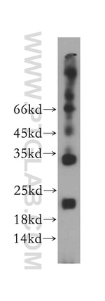 TMEM27 Antibody in Western Blot (WB)