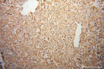 PPM1K Antibody in Immunohistochemistry (Paraffin) (IHC (P))
