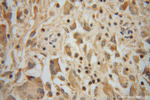 PPM1K Antibody in Immunohistochemistry (Paraffin) (IHC (P))