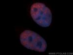 SF3B3 Antibody in Immunocytochemistry (ICC/IF)