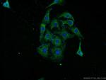 Pikachurin Antibody in Immunocytochemistry (ICC/IF)