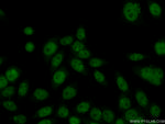 HMG20B Antibody in Immunocytochemistry (ICC/IF)