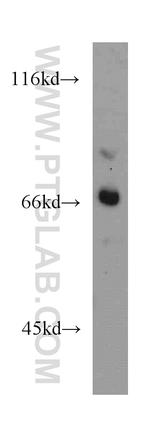 CES3 Antibody in Western Blot (WB)