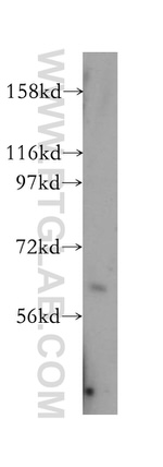 CES3 Antibody in Western Blot (WB)