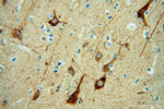 FBXO2 Antibody in Immunohistochemistry (Paraffin) (IHC (P))