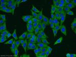 ERI1 Antibody in Immunocytochemistry (ICC/IF)